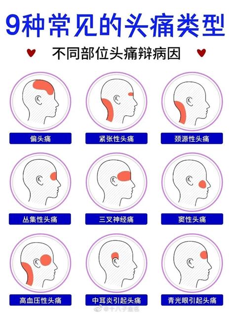 头疼|头痛症状